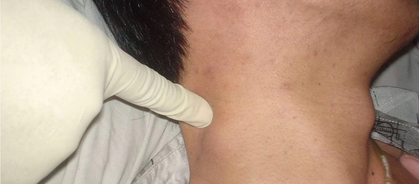 Λέμφωμα Χότζκιν και λέμφωμα μη-Χότζκιν: Ποιες είναι οι διαφορές τους και πως δημιουργούνται; (βίντεο)